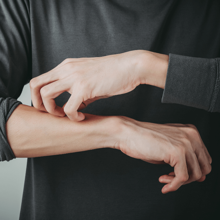 5 Tips to Relieve Skin Irritation From Eczema - FORK & MELON